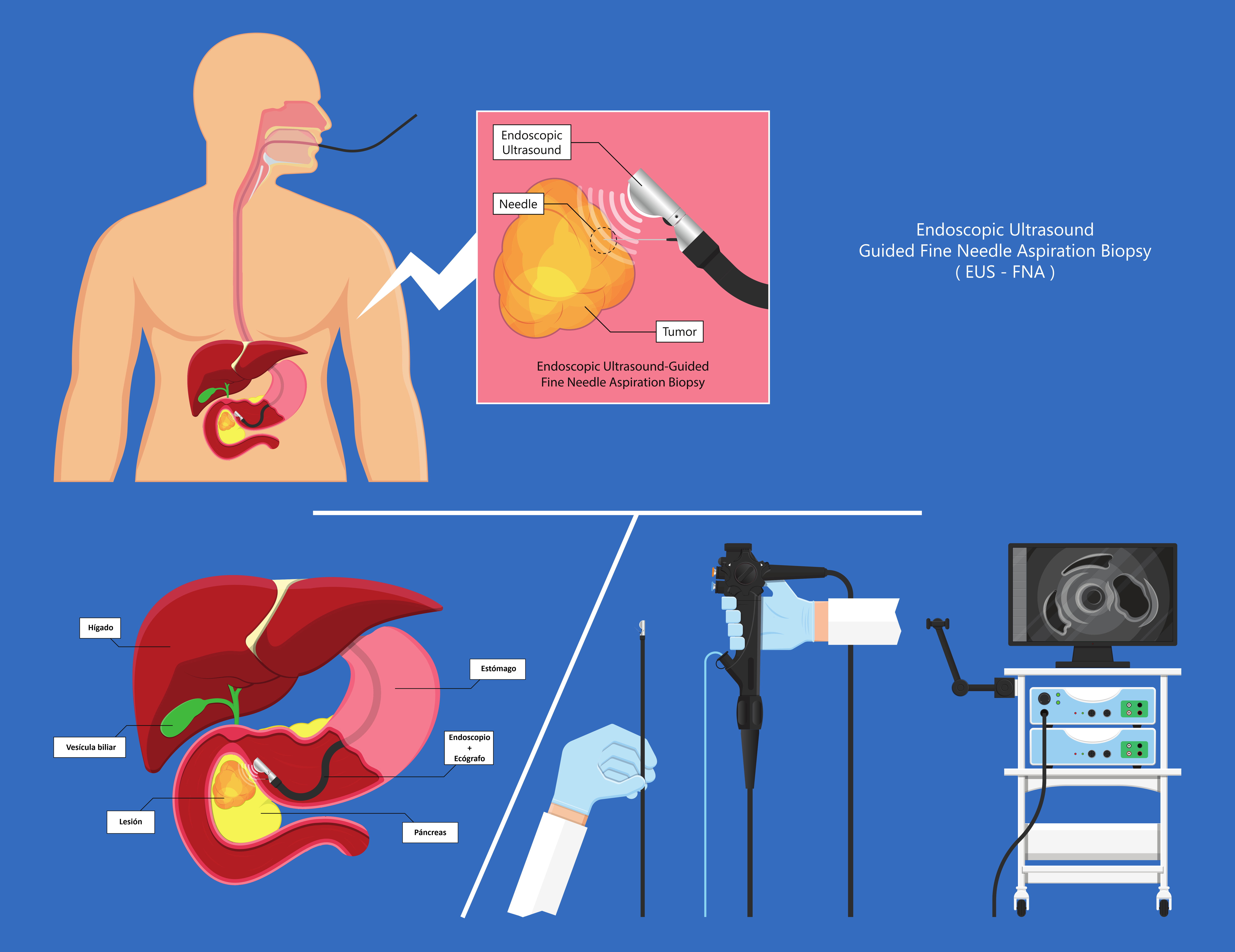 Colonoscopia diagnostica